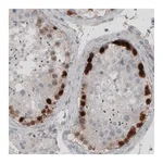 Atlas Antibodies Anti-SSX2 Antibody