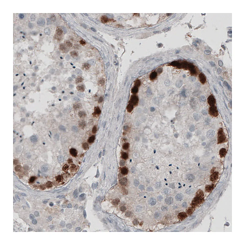 Atlas Antibodies Anti-SSX2 Antibody