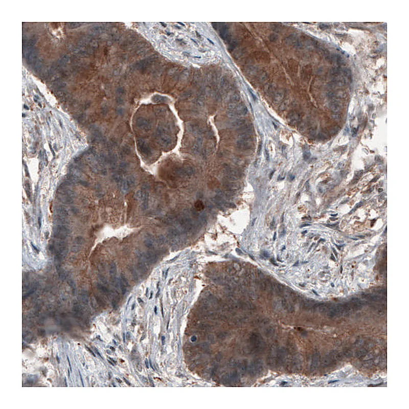 Atlas Antibodies Anti-ST13 Antibody