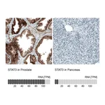 Atlas Antibodies Anti-STAT3 Antibody