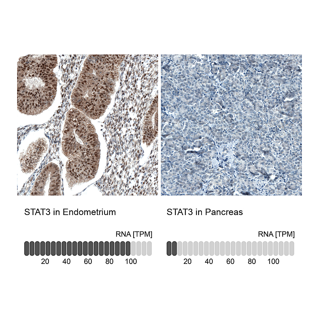 Atlas Antibodies Anti-STAT3 Antibody