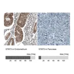 Atlas Antibodies Anti-STAT3 Antibody