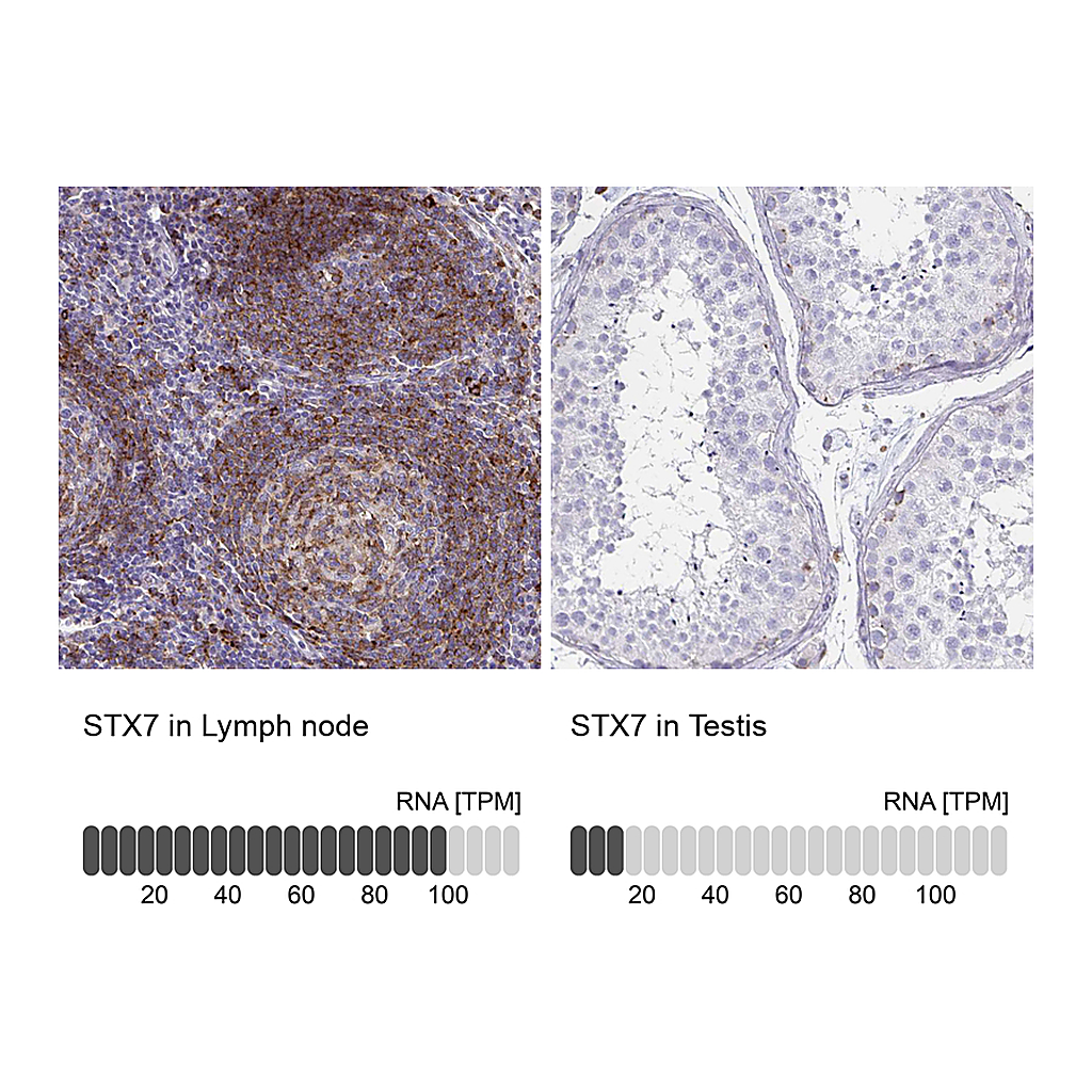 Atlas Antibodies Anti-STX7 Antibody