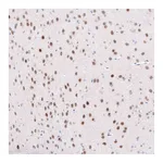 Atlas Antibodies Anti-TCF7L2 Antibody