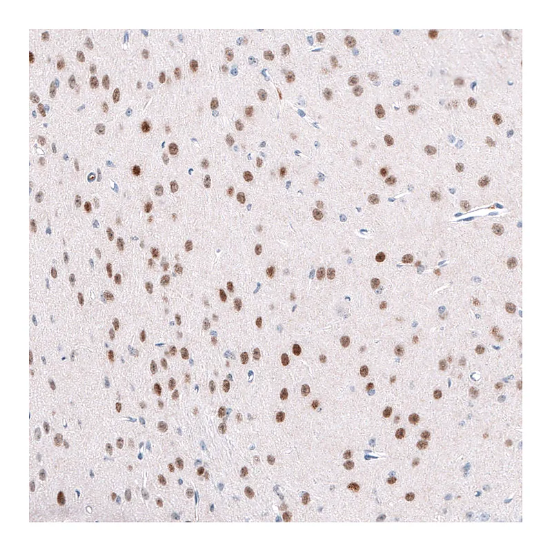 Atlas Antibodies Anti-TCF7L2 Antibody