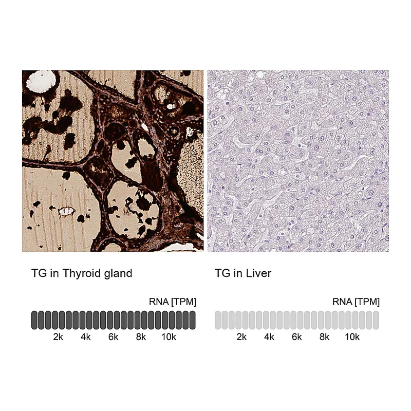 Atlas Antibodies Anti-TG Antibody