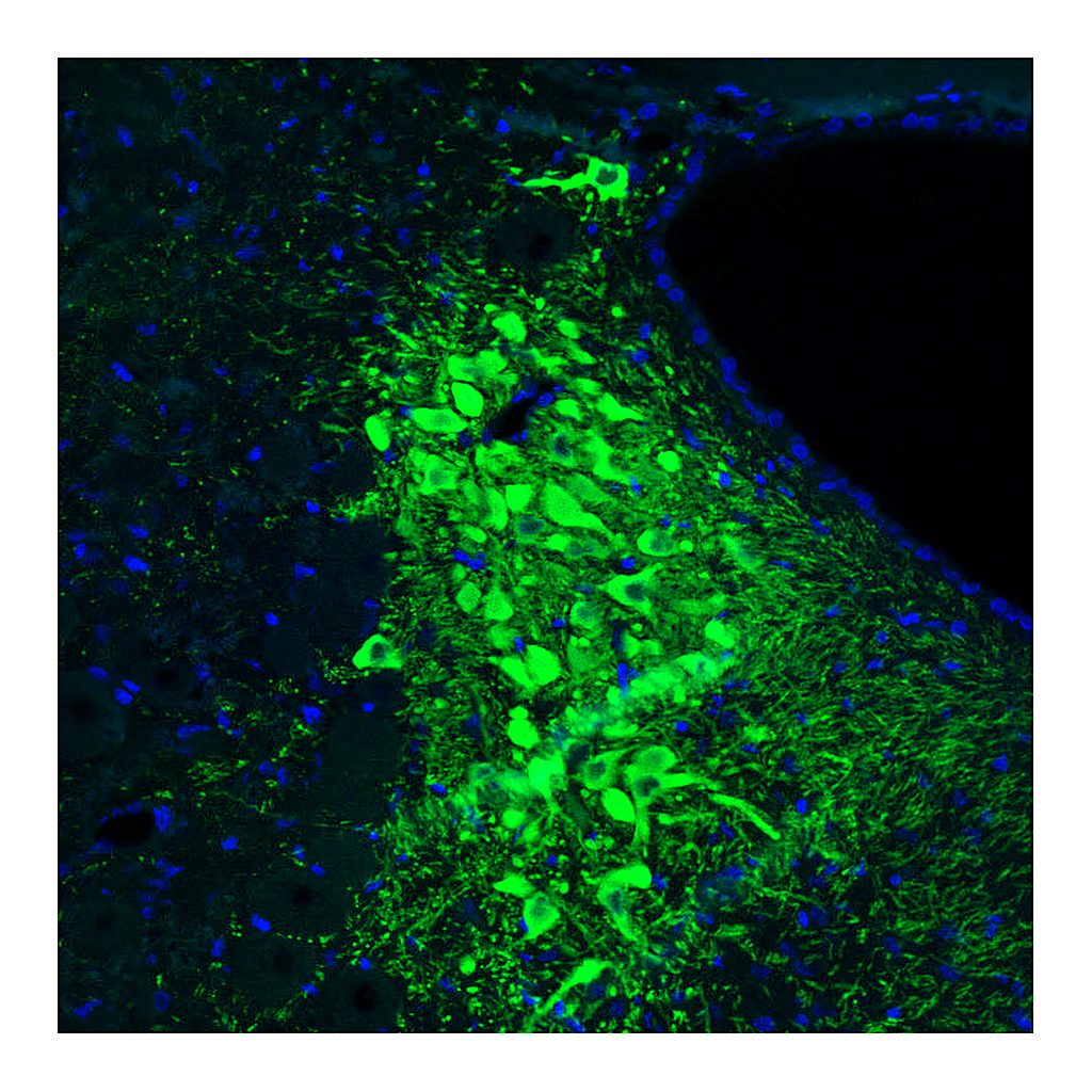 Atlas Antibodies Anti-TH Antibody