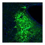 Atlas Antibodies Anti-TH Antibody