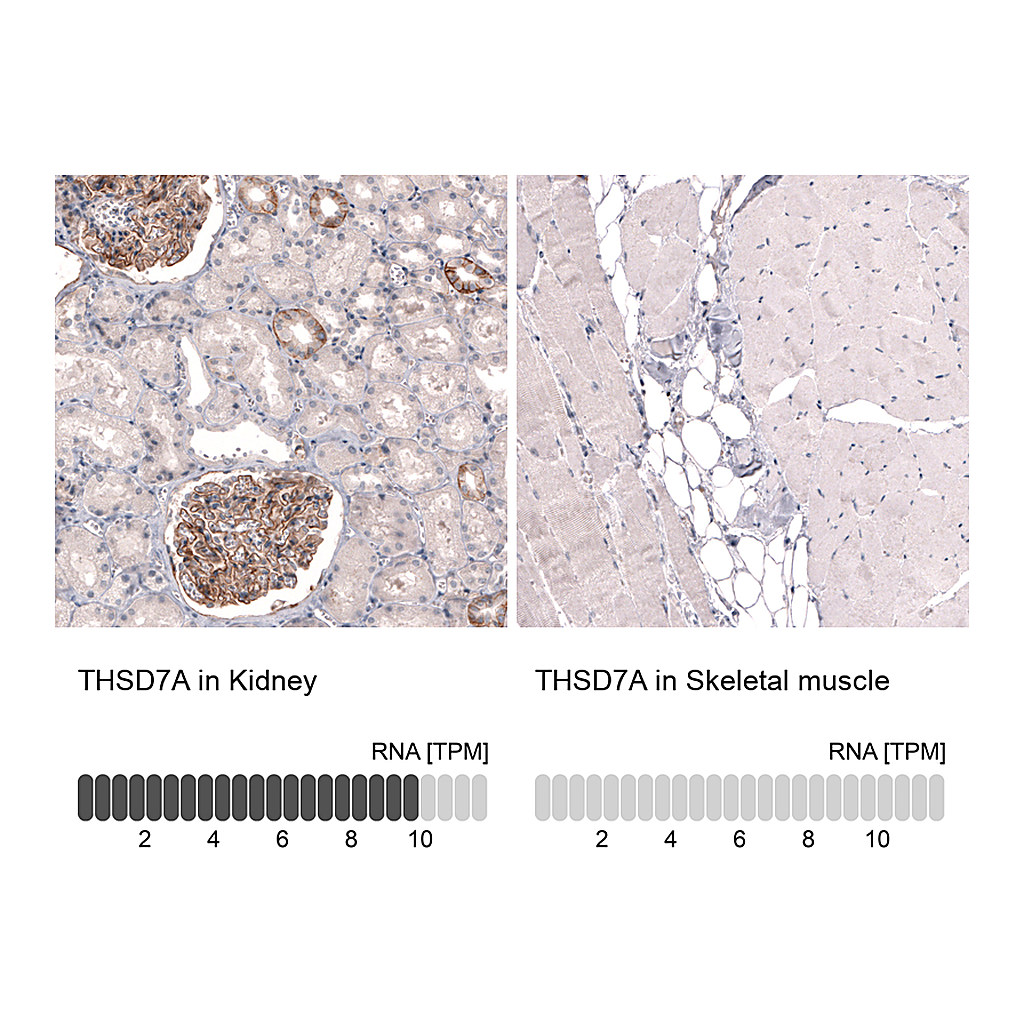 Atlas Antibodies Anti-THSD7A Antibody