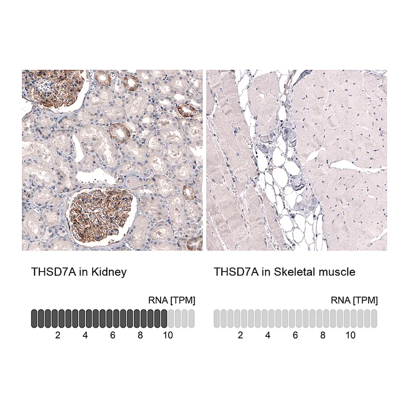 Atlas Antibodies Anti-THSD7A Antibody