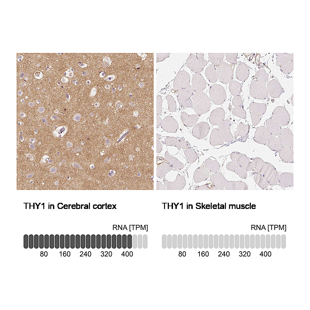 Atlas Antibodies Anti-THY1 Antibody