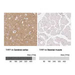 Atlas Antibodies Anti-THY1 Antibody