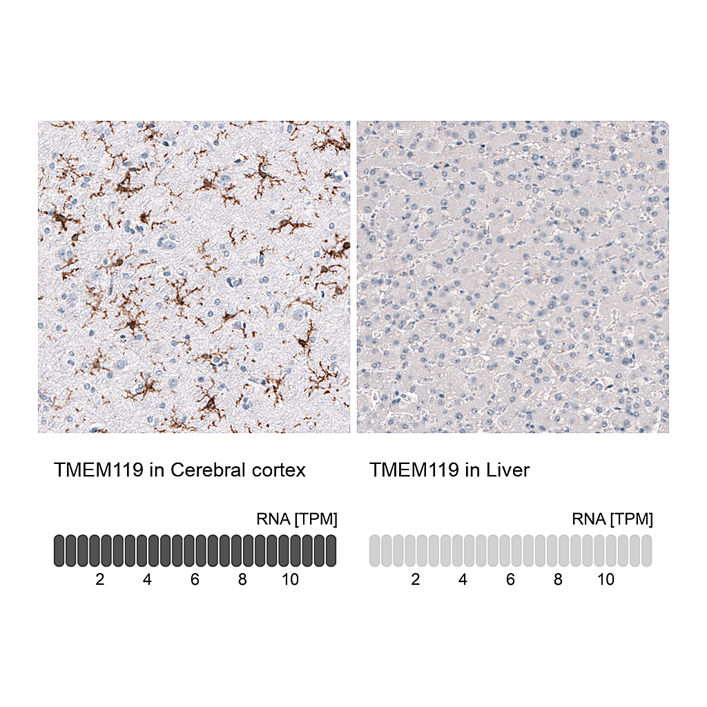 Atlas Antibodies Anti-TMEM119 Antibody