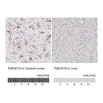 Atlas Antibodies Anti-TMEM119 Antibody