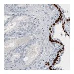 Atlas Antibodies Anti-TP63 Antibody