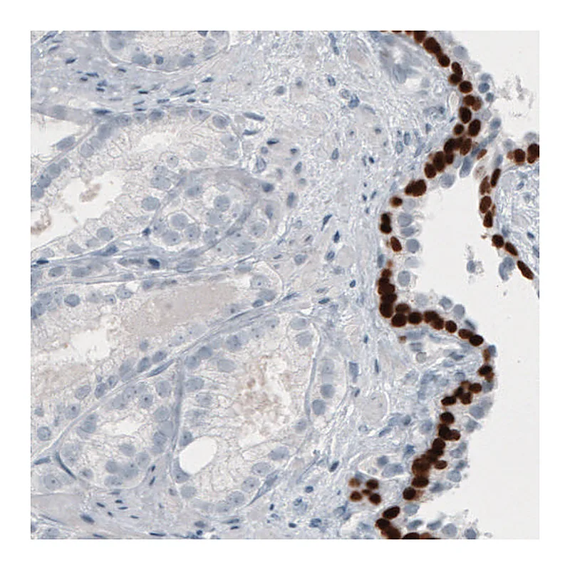 Atlas Antibodies Anti-TP63 Antibody