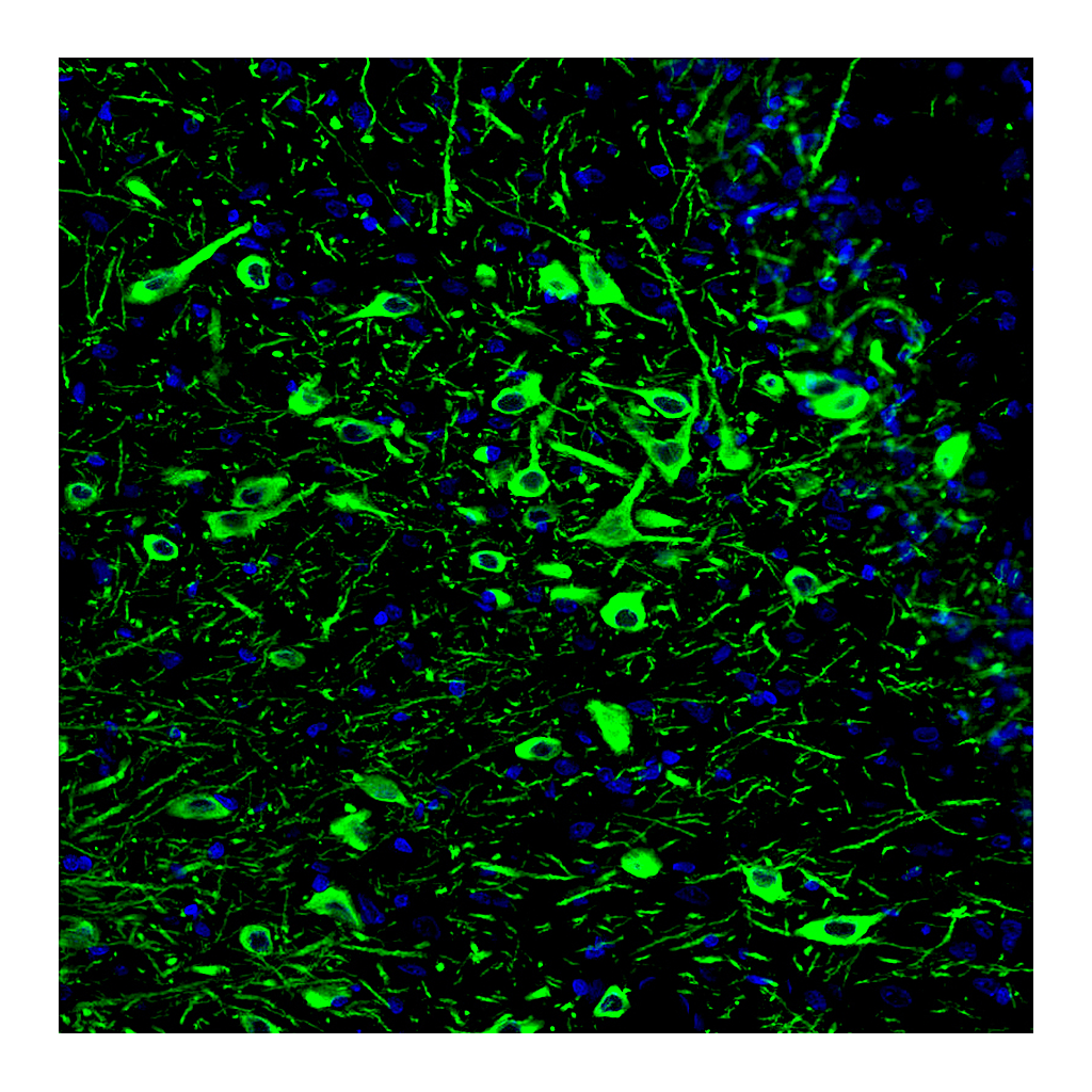 Atlas Antibodies Anti-TPH2 Antibody