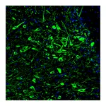 Atlas Antibodies Anti-TPH2 Antibody