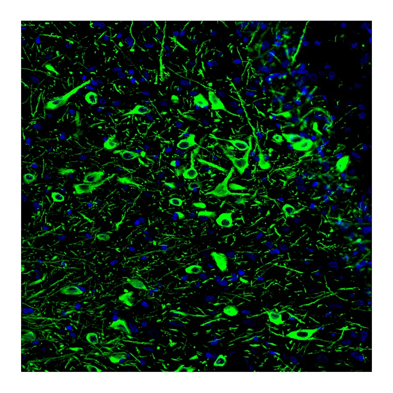 Atlas Antibodies Anti-TPH2 Antibody