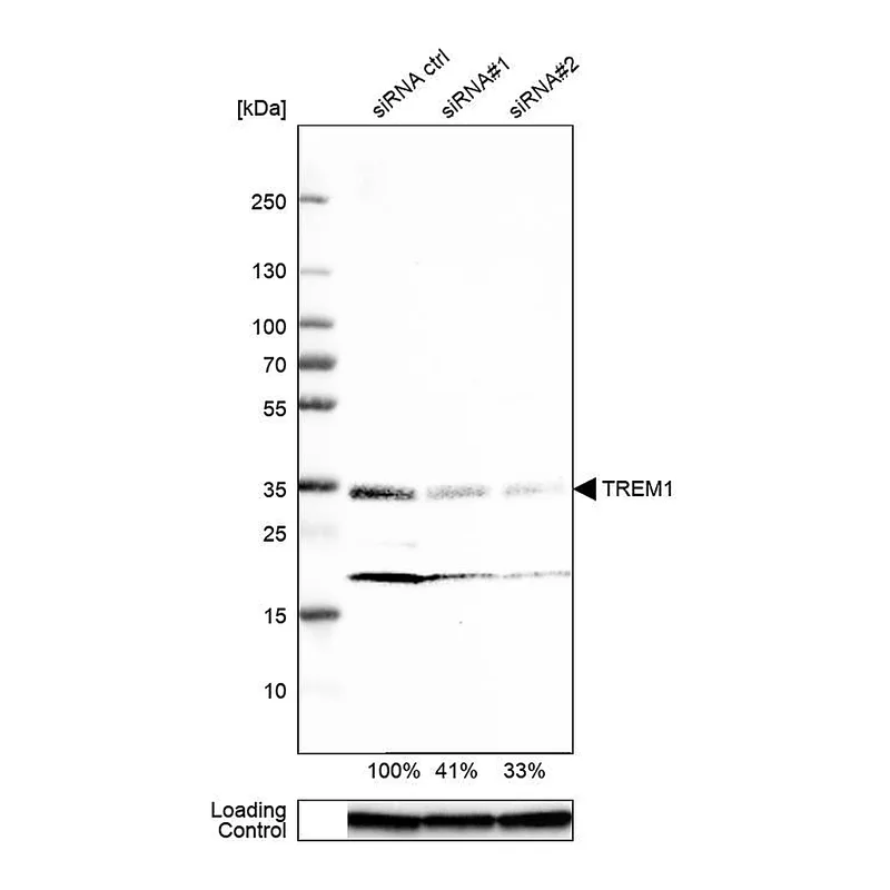 Atlas Antibodies Anti-TREM1 Antibody