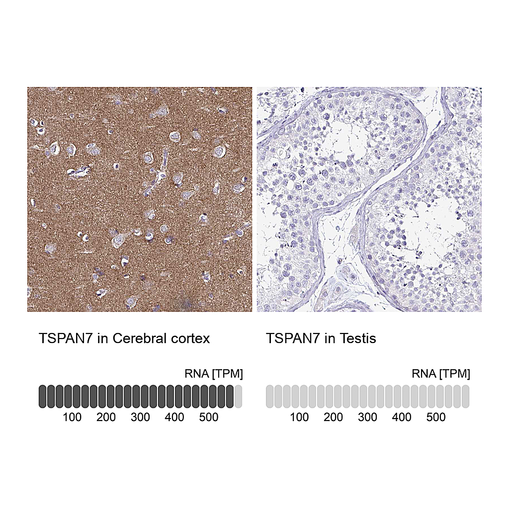 Atlas Antibodies Anti-TSPAN7 Antibody