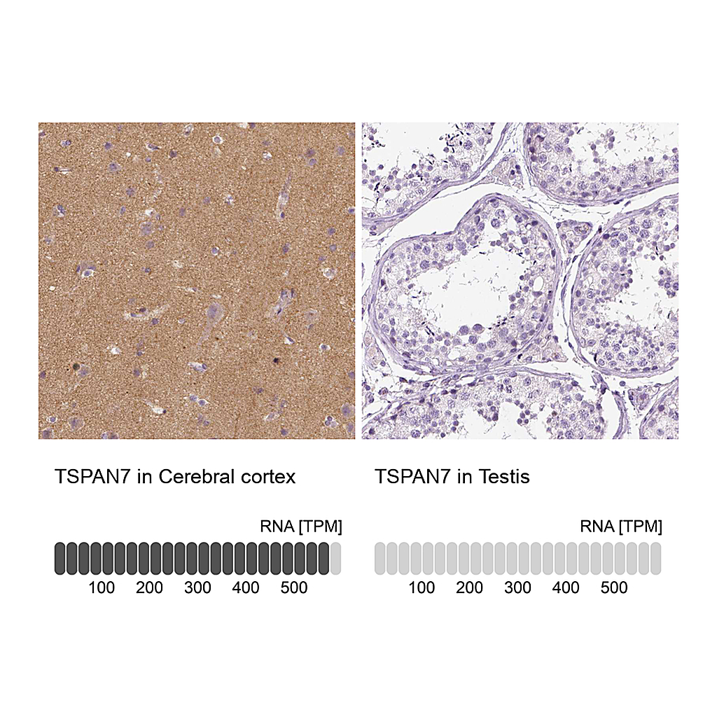 Atlas Antibodies Anti-TSPAN7 Antibody