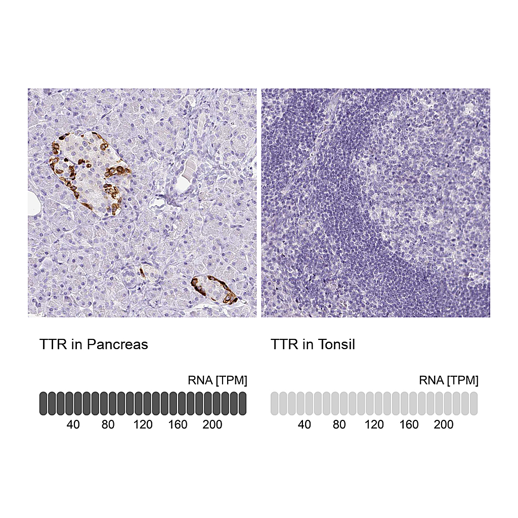 Atlas Antibodies Anti-TTR Antibody