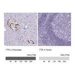 Atlas Antibodies Anti-TTR Antibody