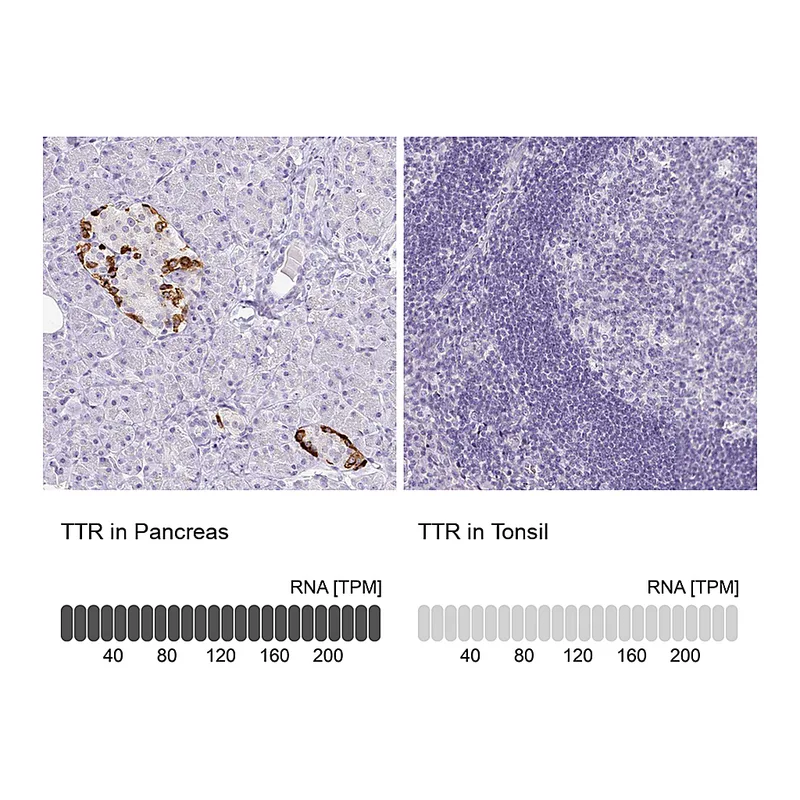 Atlas Antibodies Anti-TTR Antibody