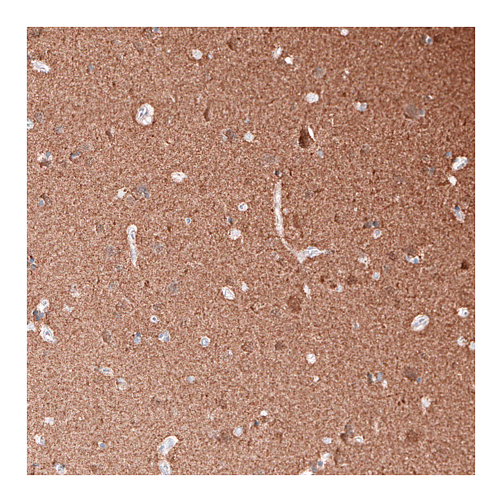 Atlas Antibodies Anti-TUBB3 Antibody