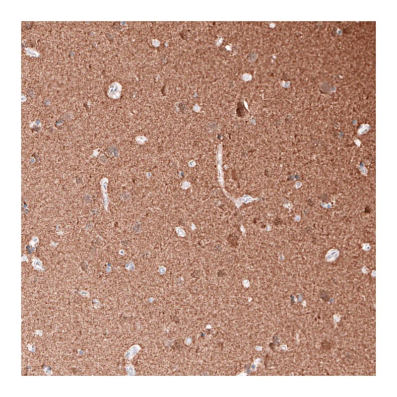 Atlas Antibodies Anti-TUBB3 Antibody