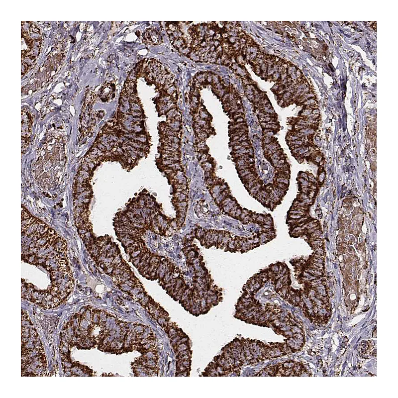 Atlas Antibodies Anti-TUFM Antibody