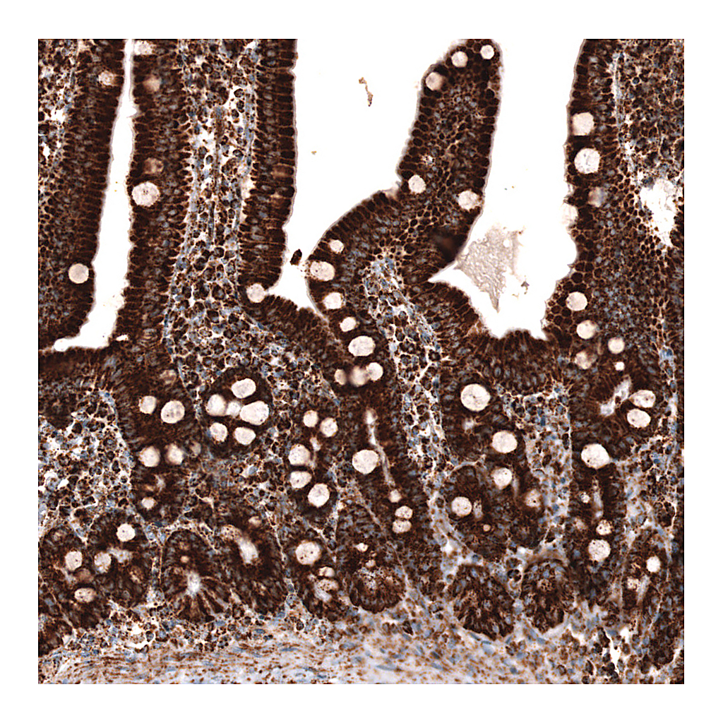 Atlas Antibodies Anti-TUFM Antibody