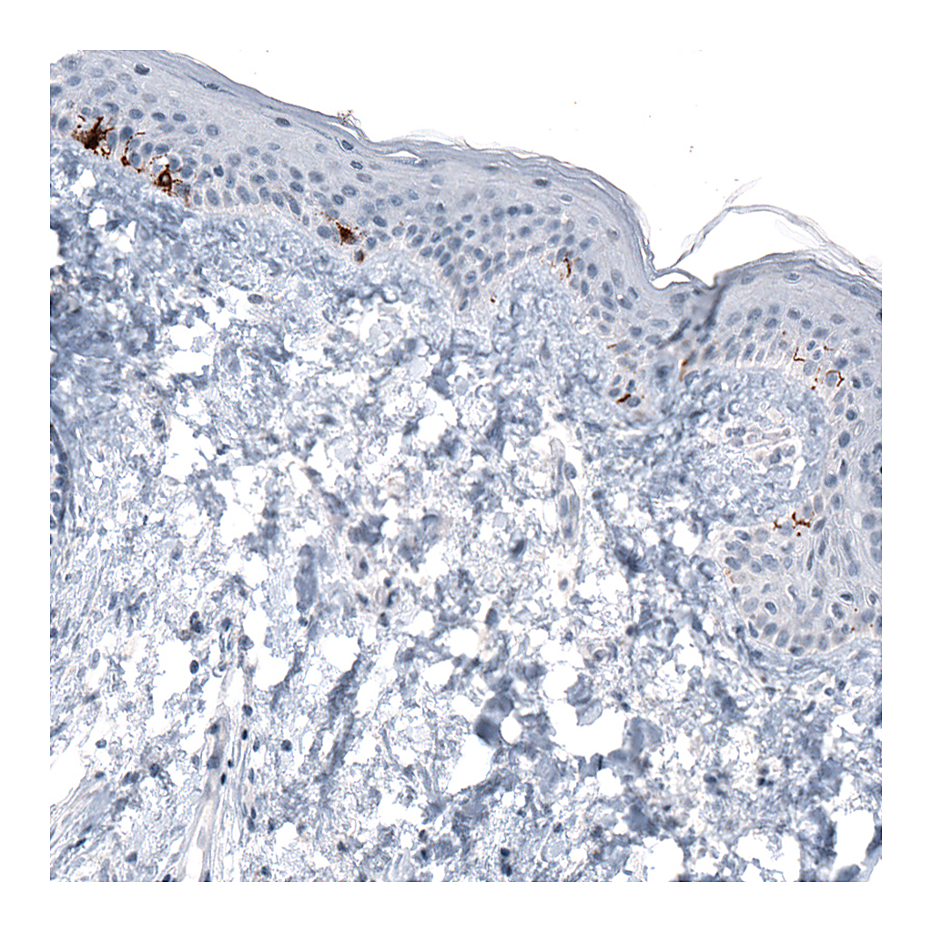 Atlas Antibodies Anti-TYRP1 Antibody