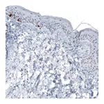 Atlas Antibodies Anti-TYRP1 Antibody
