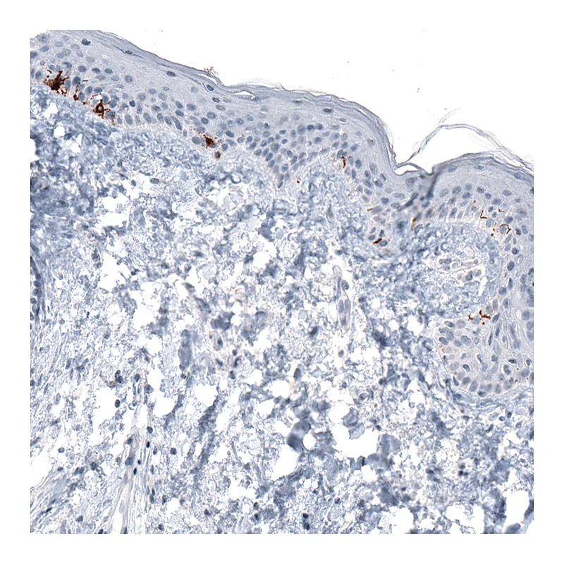 Atlas Antibodies Anti-TYRP1 Antibody