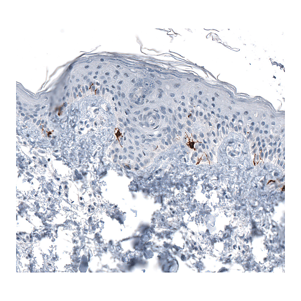 Atlas Antibodies Anti-TYRP1 Antibody