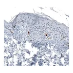 Atlas Antibodies Anti-TYRP1 Antibody