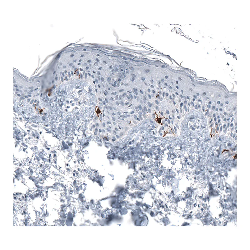 Atlas Antibodies Anti-TYRP1 Antibody
