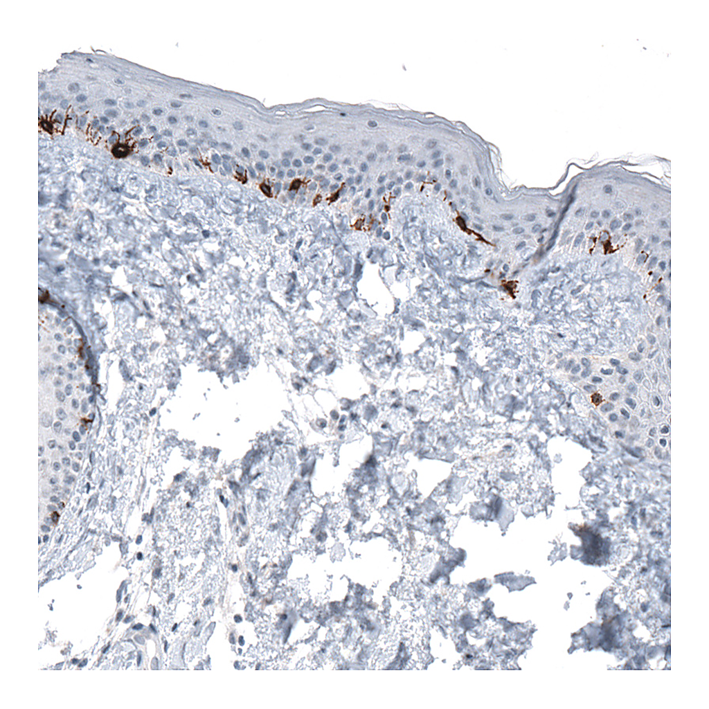 Atlas Antibodies Anti-TYRP1 Antibody