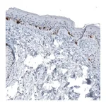 Atlas Antibodies Anti-TYRP1 Antibody