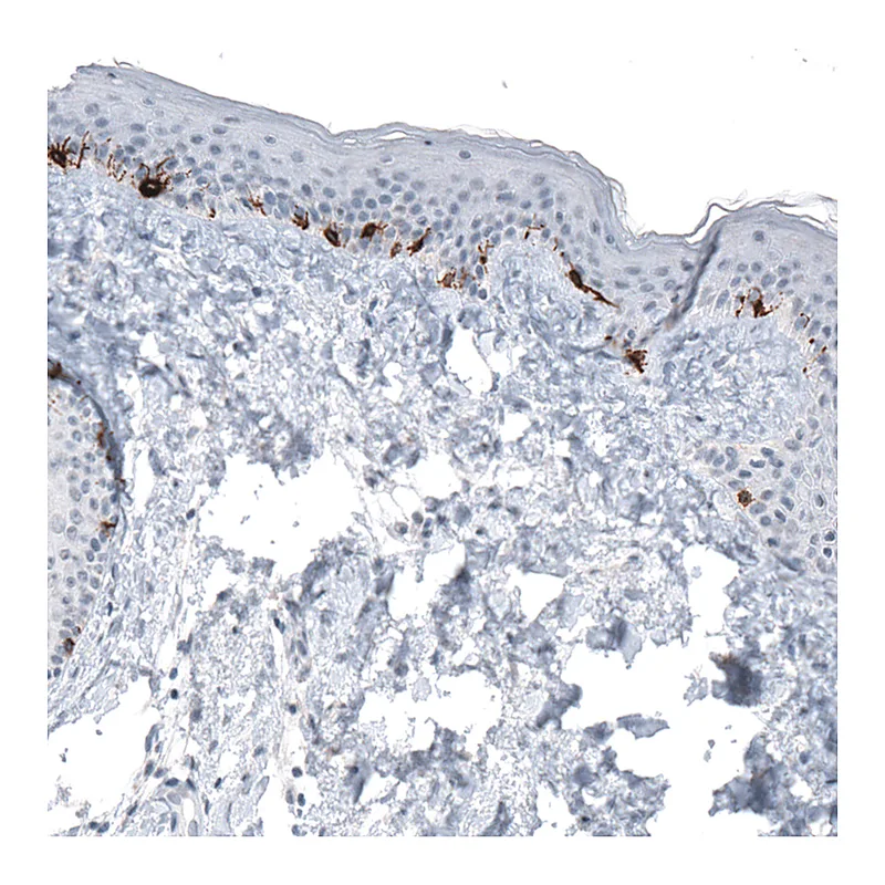 Atlas Antibodies Anti-TYRP1 Antibody