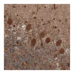 Atlas Antibodies Anti-UCHL1 Antibody