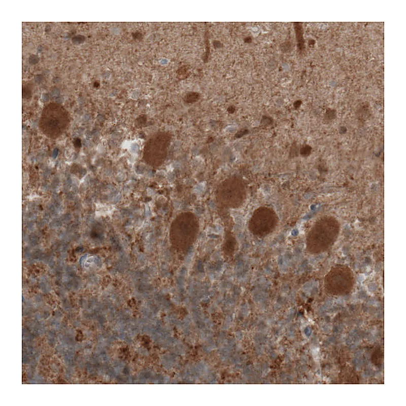 Atlas Antibodies Anti-UCHL1 Antibody