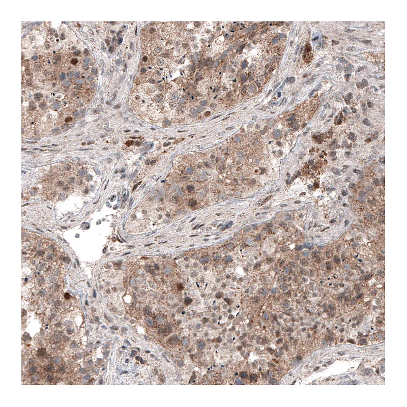 Atlas Antibodies Anti-USP30 Antibody