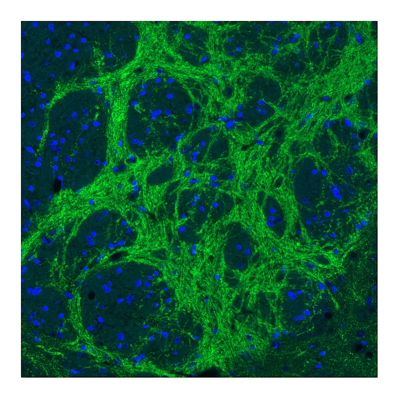 Atlas Antibodies Anti-VGAT Antibody