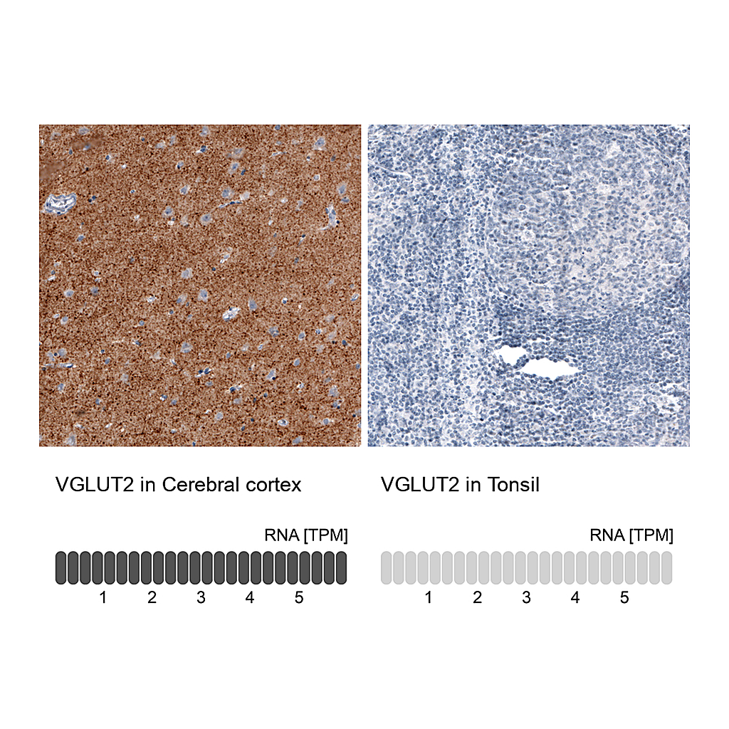 Atlas Antibodies Anti-VGLUT2 Antibody