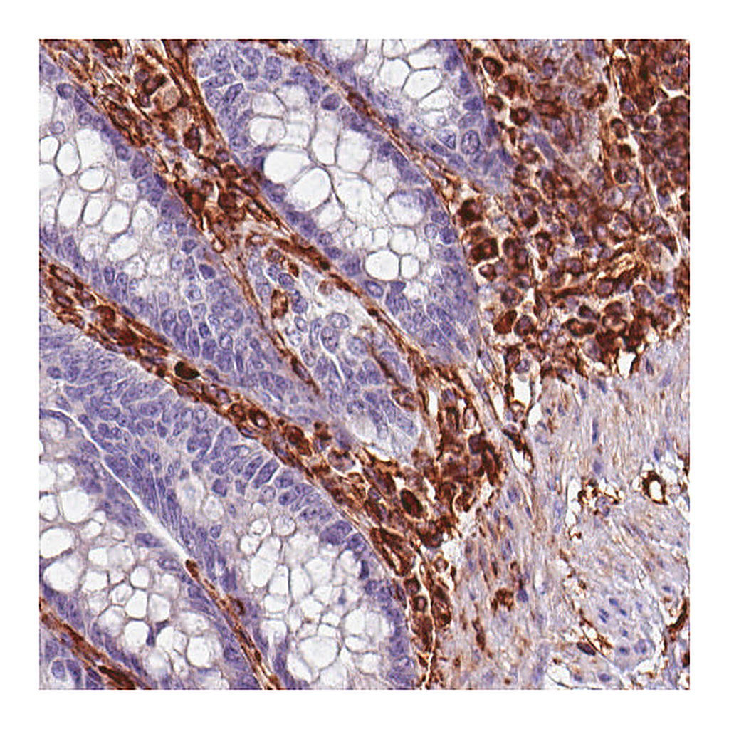 Atlas Antibodies Anti-VIM Antibody