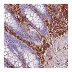 Atlas Antibodies Anti-VIM Antibody