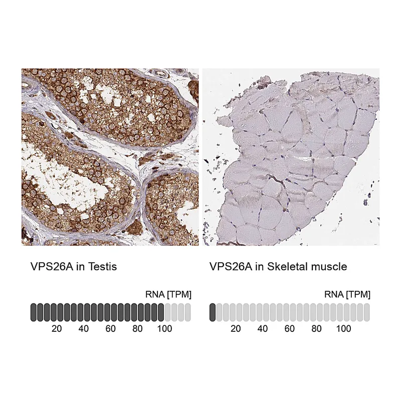 Atlas Antibodies Anti-VPS26A Antibody
